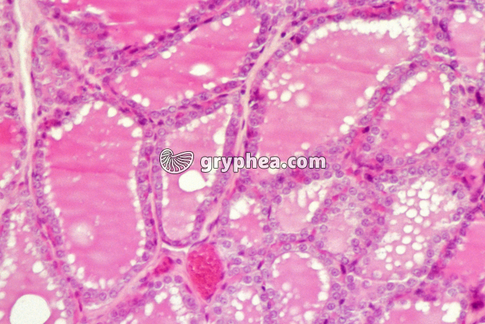 Thyroïde normale x70 - gryphea.com